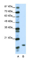 Anti-DR1 antibody - ChIP Grade (ab50783) at 1.25 µg/ml + Transfected 293T Cell Lysate at 10 µgSecondaryHRP conjugated anti-Rabbit IgG at 50000