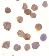 ab8412 at 10µg/ml staining DR3 in Jurkat cells by ICC/IF