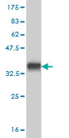 Western blot against tagged recombinant protein immunogen using ab57791 DR3 antibody at 1ug/ml.