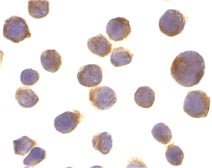 ab8414 at 10µg/ml staining DR4 in Jurkat cells by ICC/IF