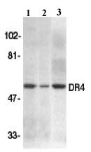 All lanes : Anti-DR4 antibody (ab8415)Lane 1 : H: HeLaLane 2 : K: K562Lane 3 : J: Jurkat whole cell lysateObserved band size : 57 kDa (why is the actual band size different from the predicted?)