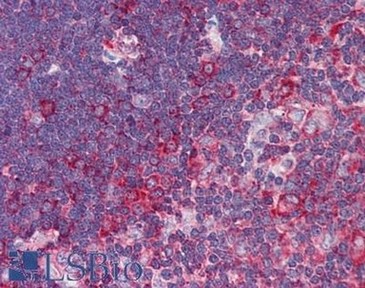 Immunohistochemical analysis of formalin-fixed, paraffin-embedded Human thymus tissue labeling DR4 with ab190230 at 5 µg/ml, then with biotinylated secondary antibody, followed by alkaline phosphatase-streptavidin and chromogen.