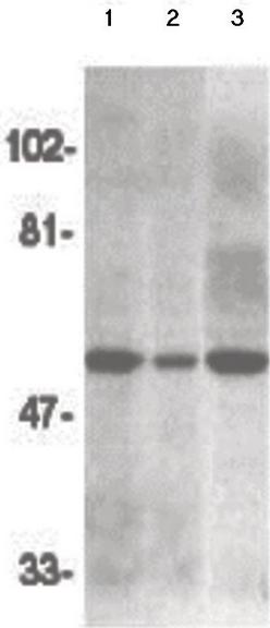 All lanes : Anti-DR4 antibody - N-terminal (ab190230) at 1/500 dilutionLane 1 : HeLa whole cell lysateLane 2 : K562 whole cell lysateLane 3 : Jurkat whole cell lysate