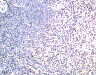 ab1675, at a dilution of 1/300, staining DR5 in human spleen section by Immunohistochemistry (Formalin/PFA-fixed paraffin-embedded sections).