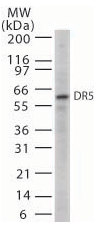 Anti-DR5 antibody (ab47179) at 1/1000 dilution + HL60 whole cell lysate at 20 µg