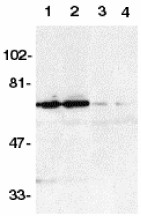 All lanes : Anti-DR6 antibody (ab8417) at 1/500 dilutionLane 1 : K562 whole cell lysate with absence of blocking peptideLane 2 : Raji whole cell lysate with absence of blocking peptideLane 3 : K562 whole cell lysate with Human DR6 peptide (ab8450)Lane 4 : Raji whole cell lysate with Human DR6 peptide (ab8450)Observed band size : 68 kDa (why is the actual band size different from the predicted?)