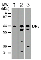 All lanes : Anti-DR6 antibody (ab47180) at 2 µg/mlLane 1 : Total cell lysate from Jurkat cellsLane 2 : Total cell lysate from HeLa cellsLane 3 : Total cell lysate from Daudi cellsLysates/proteins at 30 µg per lane.