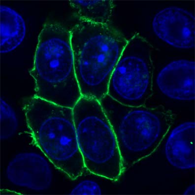 ab14740 staining DR6 (green) in transiently transfected human Hela cells by ICC/IF. Nuclei were stained with DAPI (blue).