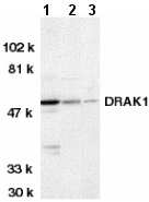 All lanes : Anti-DRAK1 antibody (ab8418) at 1/500 dilutionLane 1 : MOLT4 whole cell lysateLane 2 : A431 whole cell lysateLane 3 : 3T3 whole cell lysateObserved band size : 50 kDa (why is the actual band size different from the predicted?)