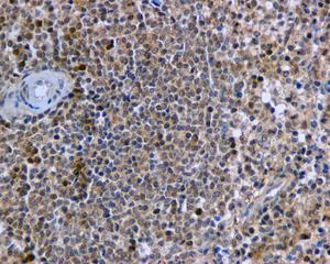 Immunohistochemical analysis of paraffin-embedded, formalin-fixed Human spleen tissue labeling DRIL1 with ab169787 at 1/50 dilution.