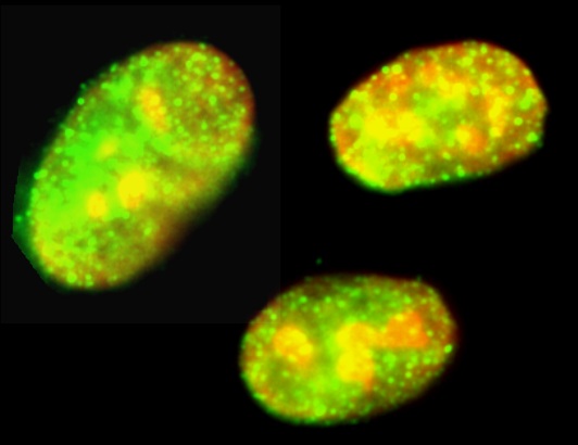 Human female amniocytes immunostained with ab12286 Drosha (FITC) (1/25 dilution). The DNA is labelled red with propidium iodide. This image was submitted as part of a review by Ahmad Khalil.