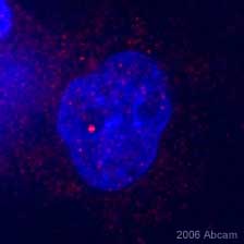 ab12286 at a 1/25 dilution staining human HeLa cells by immunocytochemistry. The antibody was incubated with the cells for 1 hour and then detected using a Cy3 conjugated donkey anti-rabbit polyclonal antibody. This image is courtesy of an Abreview submitted on 7 February 2006.See Abreview