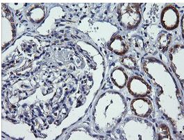 Immunohistochemical analysis of paraffin embedded Human kidney tissue labeling DNM1L with ab150336 at 1/150 dilution.