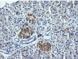 Immunohistochemical analysis of paraffin embedded Human pancreas tissue labeling DNM1L with ab150336 at 1/150 dilution.