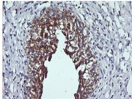 Immunohistochemical analysis of paraffin embedded Human bladder tissue labeling DNM1L with ab150336 at 1/150 dilution.