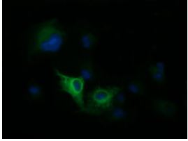 Immunofluorescent analysis of COS7 cells transiently transfected with pCMV6-ENTRY DNM1L using ab150336 at 1/100 dilution.