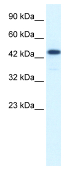 Anti-CoREST3 / RCOR3 antibody (ab50197) at 1.25 µg/ml + Jurkat cell lysate at 10 µgSecondaryHRP conjugated anti-Rabbit IgG at 1/50000 dilution