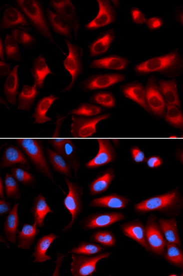 Immunocytochemistry/Immunofluorescence analysis of U2OS cells using ab180769. Blue DAPI for nuclear staining.