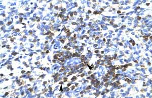Immunohistochemistry (Formalin/PFA-fixed paraffin-embedded sections) analysis of human spleen tissue labelling CoREST3 / RCOR3 with ab50197 at 4-8µg/ml. Arrows indicate positive staining.