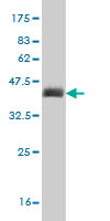 Western blot against tagged recombinant protein immunogen using ab56983 LRP4 antibody at 1ug/ml.