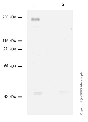 All lanes : Anti-Corin antibody (ab56158) at 1/1000 dilutionLane 1 : Whole cell lysate prepared from cells transfected with human CorinLane 2 : Whole cell lysate - control transfectionLysates/proteins at 10 µl per lane.