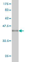 Western blot against tagged recombinant protein immunogen using ab55019 DTYMK antibody at 1ug/ml.
