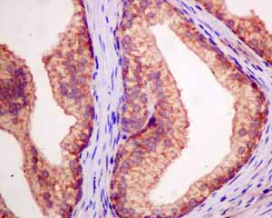 Immunohistochemical analysis of paraffin embedded Human prostate hyperplasia tissue using ab154867 showing +ve staining.