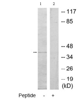 All lanes : Anti-DUSP9 antibody (ab70129) at 1/500 dilutionLane 1 : extracts from HeLa cellsLane 2 : extracts from HeLa cells with immunising peptide at 10 µgLysates/proteins at 30 µg per lane.