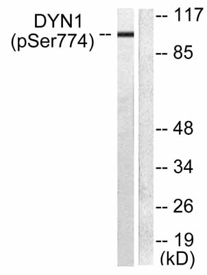 All lanes : Anti-Dynamin 1 (phospho S774) antibody (ab55324) at 1/500 dilutionLane 1 : Mouse brain extractLane 2 : Mouse brain extract treated with the immunising phosphopeptide.