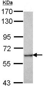Anti-CORO2B antibody (ab151327) at 1/1000 dilution + U87-MG whole cell lysate at 30 µg
