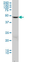 Dynamitin antibody (ab56687) at 1ug/lane + MCF-7 cell lysate at 25ug/lane.