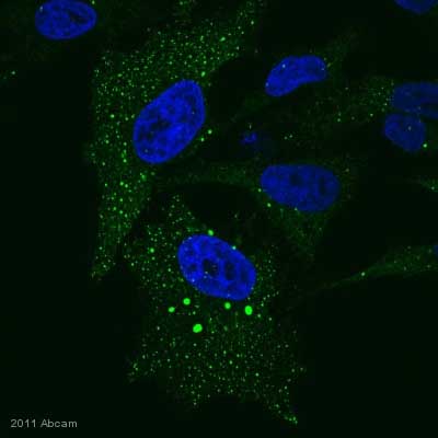 ab55687 staining Dynamitin in HeLa cells by Immunocytochemistry/ Immunofluorescence. The cells were fixed in formaldehyde, permeabilised in 0.5% Triton X and then blocked using 3% BSA for 1 hour at 24°C. Samples were then incubated with the primary antibody at 1/100 for 1 hour at 24°C. The secondary antibody used was a chicken anti-mouse IgG conjugated to Alexa Fluor® 488 (green) used at a 1/1000 dilution.See Abreview