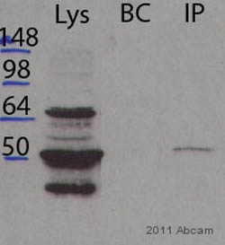 Total protein input, Hela cell lysate: 500µg.Matrix used for Immunoprecipitation step: Protein A Dynabeads.ab56687 used at a 1/1000 dilution, 20µl/mg lysate.LYS - Lysates BC - Beads + Lysates IP - Beads + Ab + LysatesSee Abreview