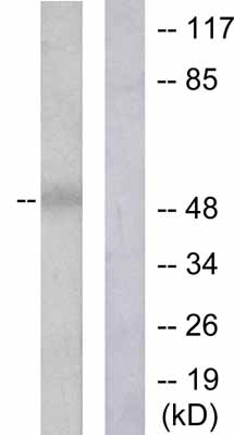 All lanes : Anti-Dynamitin antibody (ab53714) at 1/500 dilutionLane 1 : Extracts from A549 cellsLane 2 : Extracts from A549 cells, plus immunising peptide