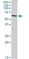 Anti-CORO2B antibody (ab88379) at 5 µg/ml + A431 cell lysate at 25 µg