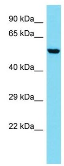 Anti-CORO2B antibody - N-terminal (ab157560) at 1 µg/ml + Mouse Lung lysate at 10 µg