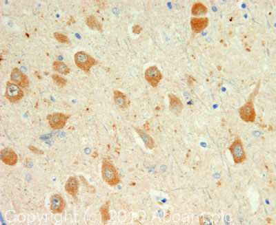 IHC image of Dynorphin A staining in human hippocampus formalin fixed paraffin embedded tissue section, performed on a Leica BondTM system using the standard protocol F. The section was pre-treated using heat mediated antigen retrieval with sodium citrate buffer (pH6, epitope retrieval solution 1) for 20 mins. The section was then incubated with ab82509, 5µg/ml, for 15 mins at room temperature and detected using an HRP conjugated compact polymer system. DAB was used as the chromogen. The section was then counterstained with haematoxylin and mounted with DPX