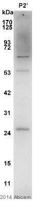 Anti-Dynorphin A antibody (ab82509) at 1/1000 dilution + Mouse synaptosome from hippocampal stratum lucidum tissue lysate at 10 µgSecondaryHRP-conjugated anti-rabbit IgG polyclonal at 1/5000 dilutiondeveloped using the ECL techniquePerformed under non-reducing conditions.