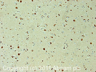 IHC image of ab40647 staining in human hippocampus formalin fixed paraffin embedded tissue section, performed on a Leica BondTM system using the standard protocol F. The section was pre-treated using heat mediated antigen retrieval with sodium citrate buffer (pH6, epitope retrieval solution 1) for 20 mins. The section was then incubated with ab40647, 1µg/ml, for 15 mins at room temperature and detected using an HRP conjugated compact polymer system. DAB was used as the chromogen. The section was then counterstained with haematoxylin and mounted with DPX.For other IHC staining systems (automated and non-automated) customers should optimize variable parameters such as antigen retrieval conditions, primary antibody concentration and antibody incubation times.