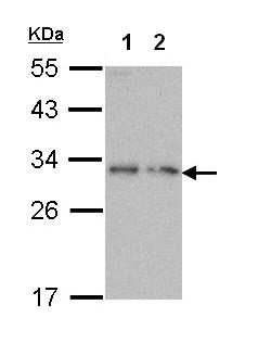 All lanes : Anti-Dynorphin A antibody (ab97798) at 1/1000 dilutionLane 1 : Molt-4 whole cell lysateLane 2 : Raji whole cell lysateLysates/proteins at 30 µg per lane.