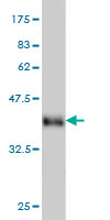 Western blot against tagged recombinant protein immunogen using ab56363 DYRK2 antibody at 1ug/ml. 