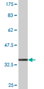 Anti-DYRK4 antibody (ab76961) at 1/500 dilution + immunogen at 0.1 µgSecondaryGoat anti-mouse IgG (H&L)-HRP conjugate at 1/5000 dilution
