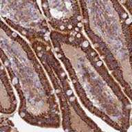ab122733 at 1/200 dilution staining CORO7 in Paraffin-embedded Human duodenum tissue by Immunohistochemistry.