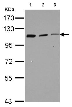 All lanes : Anti-CORO7 antibody (ab155526) at 1/1000 dilutionLane 1 : Raji whole cell lysateLane 2 : K562 whole cell lysateLane 3 : THP-1 whole cell lysateLysates/proteins at 30 µg per lane.
