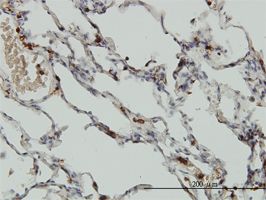 Coronin 1a antibody (ab56820) used in immunohistochemistry at 3ug/ml on formalin fixed and paraffin embedded human lung.