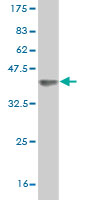 Western blot against tagged recombinant protein immunogen using ab54735 dystrophia myotonica containing WD repeat motif antibody at 1ug/ml.