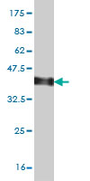 Western blot against tagged recombinant protein immunogen using ab54731 Dystrophia myotonica protein kinase antibody at 1ug/ml.