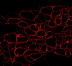 Muscle stem cells (from normal mouse) were injected into the gastric muscle of an MDX mouse. Dystrophin staining: primary antibody ab15277 and secondary antibody is donkey anti-rabbit Alexa 594.This image was kindly supplied as part of the review submitted by Jessica Tebbets. 