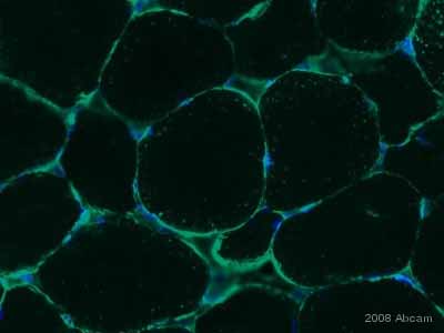 ab15277 staining dog muscle cells by ICC/IF.  Cells were methanol fixed and incubated with ab15277, diluted 1/200, for 12 hours at 4°C.  A FITC conjugated goat anti-rabbit antibody, diluted 1/200, was used as the secondary.See Abreview