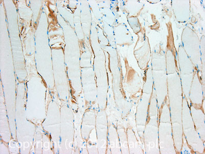 IHC image of Dystrophin staining in Human normal skeletal muscle formalin fixed paraffin embedded tissue section, performed on a Leica BondTM system using the standard protocol F. The section was pre-treated using heat mediated antigen retrieval with sodium citrate buffer (pH6, epitope retrieval solution 1) for 20 mins. The section was then incubated with ab3149, 5µg/ml, for 15 mins at room temperature and detected using an HRP conjugated compact polymer system. DAB was used as the chromogen. The section was then counterstained with haematoxylin and mounted with DPX.For other IHC staining systems (automated and non-automated) customers should optimize variable parameters such as antigen retrieval conditions, primary antibody concentration and antibody incubation times.